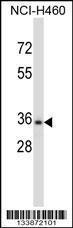 Anti-CELA3B Rabbit Polyclonal Antibody (FITC (Fluorescein Isothiocyanate))