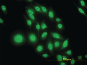 Anti-ATF4 Mouse Monoclonal Antibody [clone: 2B3]