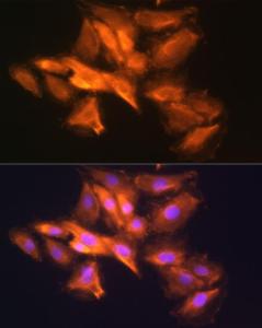 Anti-HINT1 Rabbit Polyclonal Antibody