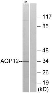 Western blot analysis of lysates from Jurkat cells using Anti-AQP12 Antibody. The right hand lane represents a negative control, where the antibody is blocked by the immunising peptide.