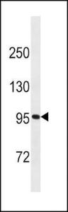 Anti-CD19 Rabbit Polyclonal Antibody (FITC (Fluorescein Isothiocyanate))