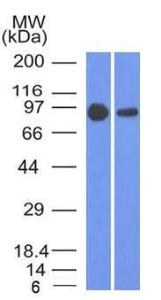 Western blot analysis of A431 and A549 cell lysates using Anti-beta Catenin Antibody [5H10]