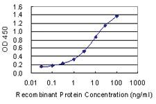 Anti-FECH Mouse Monoclonal Antibody [clone: 3H3]