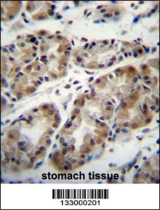 Anti-TAF8 Rabbit Polyclonal Antibody (HRP (Horseradish Peroxidase))