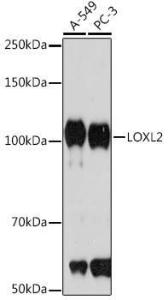 Western blot analysis of extracts of various cell lines, using Anti-LOXL2 Antibody [ARC1100] (A308036) at 1:1,000 dilution