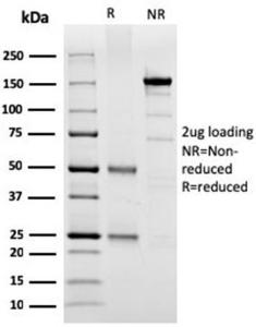 SDS-PAGE analysis of Anti-SPARC Antibody [OSTN/3304] under non-reduced and reduced conditions; showing intact IgG and intact heavy and light chains, respectively. SDS-PAGE analysis confirms the integrity and purity of the antibody.