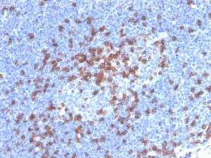 Immunohistochemical analysis of formalin-fixed, paraffin-embedded human lymph node using Anti-CD8A Antibody [CD8/4391R]