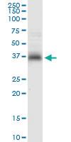 Anti-STX7 Rabbit Polyclonal Antibody