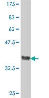 Anti-LRRC41 Mouse Polyclonal Antibody