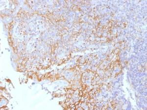 Immunohistochemical analysis of formalin-fixed, paraffin-embedded human tonsil using Anti-beta Catenin Antibody [5H10]