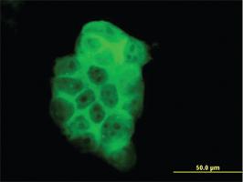 Anti-PIK3C2B Mouse Monoclonal Antibody [clone: 3E5]