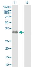 Anti-STX7 Rabbit Polyclonal Antibody