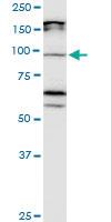 Anti-CDH11 Mouse Monoclonal Antibody [clone: 3C8]