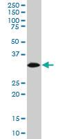 Anti-HADH Mouse Monoclonal Antibody [clone: 3C9]