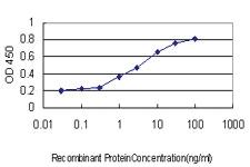 Anti-PIK3C2B Mouse Monoclonal Antibody [clone: 3E5]