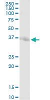 Anti-STX7 Rabbit Polyclonal Antibody