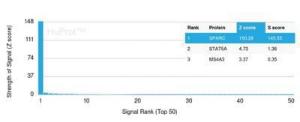 Analysis of protein array containing more than 19,000 full-length human proteins using Anti-SPARC Antibody [OSTN/3304