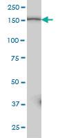 Anti-PIK3C2B Mouse Monoclonal Antibody [clone: 3E5]