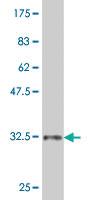 Anti-ZIC1 Mouse Monoclonal Antibody [clone: 4D2]