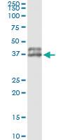 Anti-OLIG2 Antibody Pair