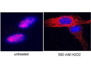 Anti-TERT Rabbit polyclonal antibody