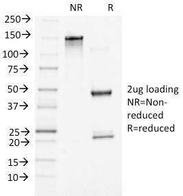 SDS-PAGE analysis of Anti-beta Catenin Antibody [5H10] under non-reduced and reduced conditions; showing intact IgG and intact heavy and light chains, respectively. SDS-PAGE analysis confirms the integrity and purity of the antibody