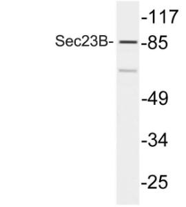 Western blot analysis of lysate from COLO205 cells using Anti-Sec23B Antibody