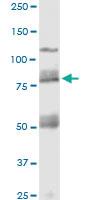 Anti-CDH11 Mouse Monoclonal Antibody [clone: 3C8]