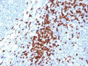 Immunohistochemical analysis of formalin-fixed, paraffin-embedded human tonsil using Anti-CD8A Antibody [CD8/4391R]