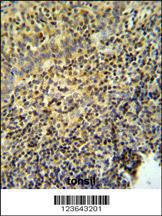 Anti-WAS Rabbit Polyclonal Antibody