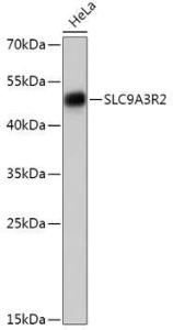 Western blot analysis of extracts of HeLa cells, using Anti-NHERF-2 / SIP-1 Antibody (A305618) at 1:1,000 dilution. The secondary antibody was Goat Anti-Rabbit IgG H&L Antibody (HRP) at 1:10,000 dilution.