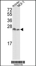 Anti-YWHAZ Rabbit Polyclonal Antibody