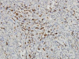 Anti-IDO1 Mouse Monoclonal Antibody [clone: 4D2]