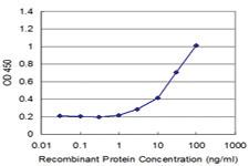 Anti-STK24 Mouse Monoclonal Antibody [clone: 1E12]