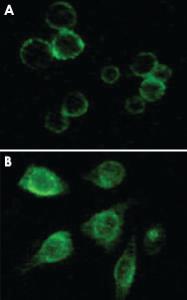 Anti-TYRO3 Mouse Monoclonal Antibody [clone: 1C10E8,9A3F2]