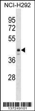 Anti-ESX1 Rabbit Polyclonal Antibody (AP (Alkaline Phosphatase))