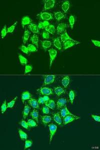 Antibody anti-RASGRP3 100 µl