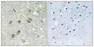 Antibody anti-APOL1 A101217-100 100 µg