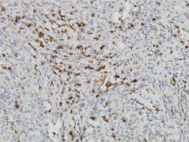 Anti-IDO1 Mouse Monoclonal Antibody [clone: 4D2]