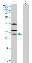 Anti-USP53 Mouse Polyclonal Antibody