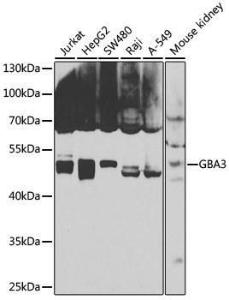 Western blot analysis of extracts of various cell lines, using Anti-GBA3 Antibody (A12174) at 1:1,000 dilution The secondary antibody was Goat Anti-Rabbit IgG H&L Antibody (HRP) at 1:10,000 dilution Lysates/proteins were present at 25 µg per lane