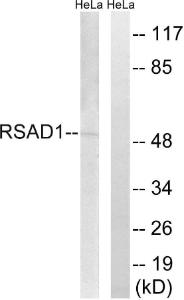 Anti-RSAD1 antibody