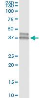 Anti-OLIG2 Antibody Pair