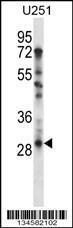 Anti-TAF9 Rabbit Polyclonal Antibody