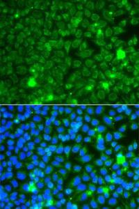 Immunofluorescence analysis of A549 cells using Anti-GBA3 Antibody (A12174) DAPI was used to stain the cell nuclei (blue)