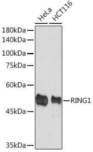 Anti-RING1 antibody