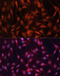 Immunofluorescence analysis of C6 cells using Anti-GNA13 Antibody (A306847) at a dilution of 1:100 (40x lens) DAPI was used to stain the cell nuclei (blue)