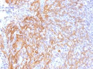 Immunohistochemical analysis of formalin-fixed, paraffin-embedded human tonsil using Anti-beta Catenin Antibody [6F9]