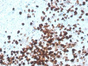 Immunohistochemical analysis of formalin-fixed, paraffin-embedded human tonsil using Anti-CD8A Antibody [CD8/4391R]