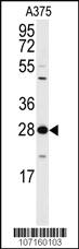 Anti-YWHAZ Rabbit Polyclonal Antibody